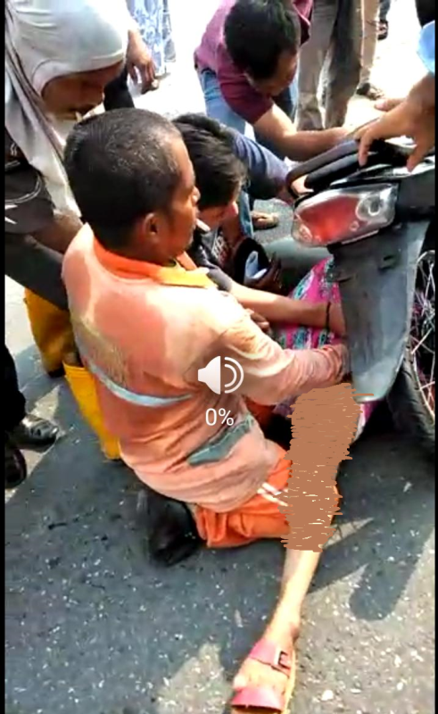 Daster Tersangkut di Rantai Sepeda Motor Dan Terseret Sepenjang 5 Meter, Nurhayati Alami Luka Berat