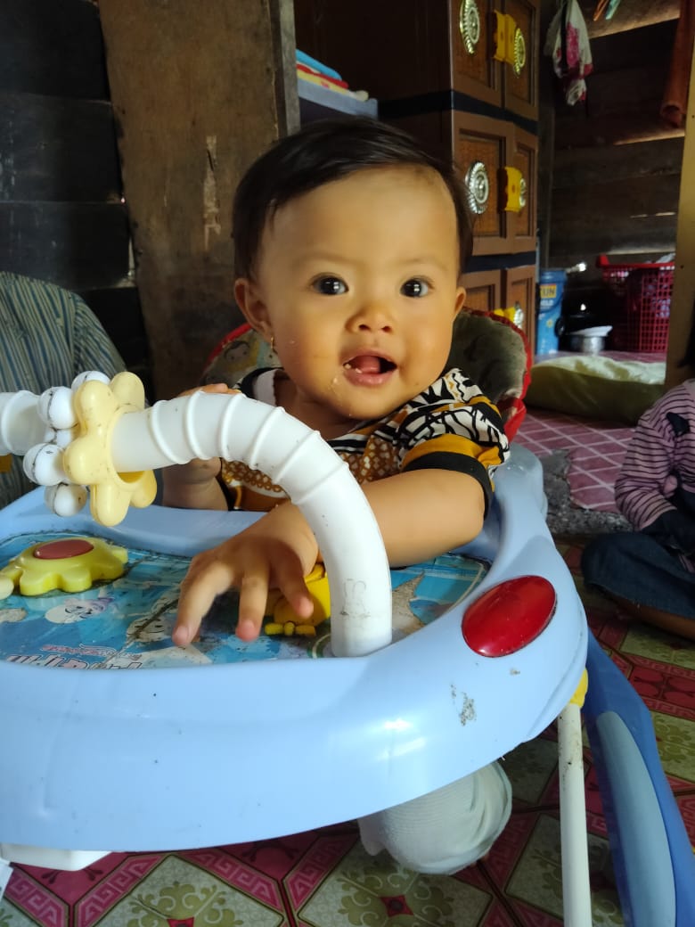 Piola Juningsih, Bayi Umur 8 Bulan Lahir Tanpa Anus, Butuh Bantuan Biaya Operasi